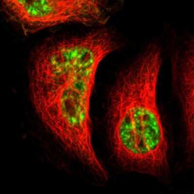 Immunocytochemistry/ Immunofluorescence: RBM25 Antibody [NBP1-83418]