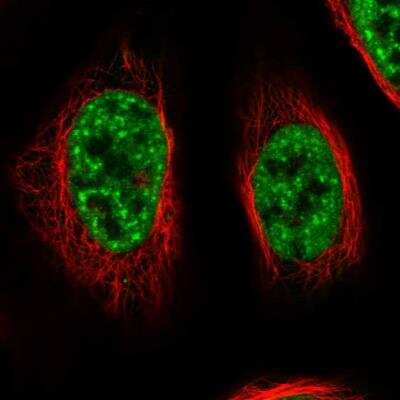 Immunocytochemistry/ Immunofluorescence: RBM26 Antibody [NBP1-89007]