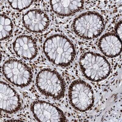Immunohistochemistry-Paraffin: RBM26 Antibody [NBP1-89007]