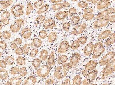 Immunohistochemistry-Paraffin: RBM28 Antibody [NBP3-12575]