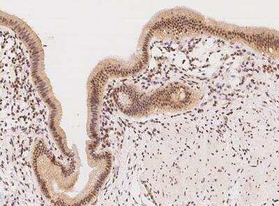 Immunohistochemistry-Paraffin: RBM28 Antibody [NBP3-12575]