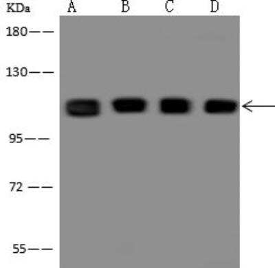 Western Blot: RBM28 Antibody [NBP3-12575]