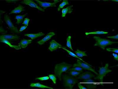 Immunocytochemistry/ Immunofluorescence: RBM3 Antibody (4D6) [H00005935-M06]