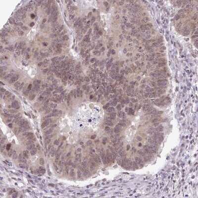 Immunohistochemistry-Paraffin: RBM3 Antibody (CL0296) [NBP2-52906]