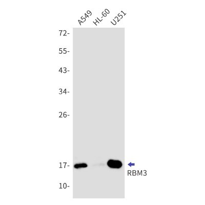 Western Blot: RBM3 Antibody (S02-0C1) [NBP3-19912]