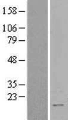 Western Blot: RBM3 Overexpression Lysate [NBL1-15205]