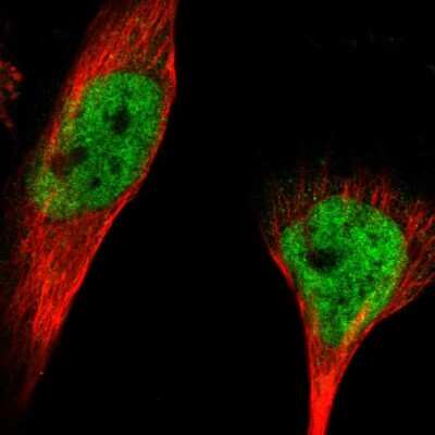 Immunocytochemistry/ Immunofluorescence: RBM33 Antibody [NBP1-84200]