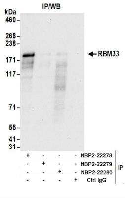 Immunoprecipitation: RBM33 Antibody [NBP2-22278]