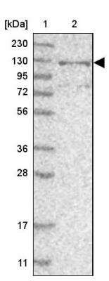 Western Blot: RBM33 Antibody [NBP1-84200]