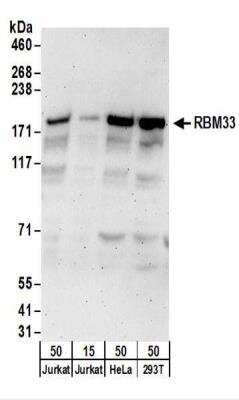 Western Blot: RBM33 Antibody [NBP2-22278]