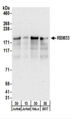 Western Blot: RBM33 Antibody [NBP2-22280]