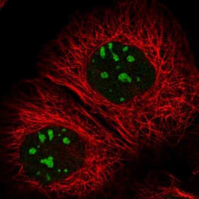 Immunocytochemistry/ Immunofluorescence: RBM34 Antibody [NBP1-83039]