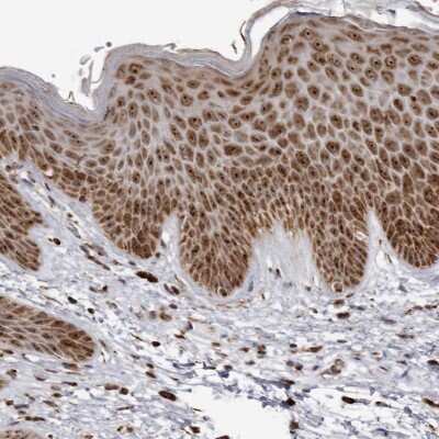 Immunohistochemistry-Paraffin: RBM34 Antibody [NBP1-83039]