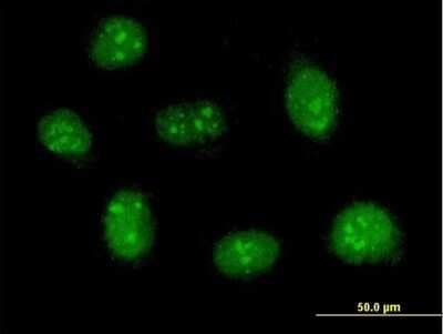 Immunocytochemistry/ Immunofluorescence: RBM41 Antibody [H00055285-B01P]