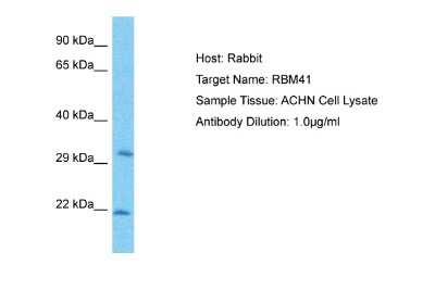 Western Blot: RBM41 Antibody [NBP2-88136]
