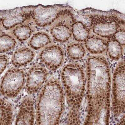 Immunohistochemistry-Paraffin: RBM42 Antibody [NBP1-82770]