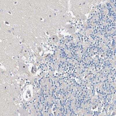 Immunohistochemistry-Paraffin: RBM43 Antibody [NBP1-86798]