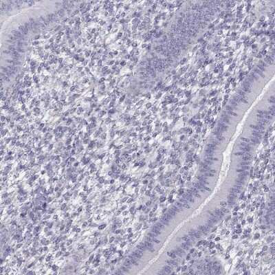 Immunohistochemistry-Paraffin: RBM44 Antibody [NBP1-93779]