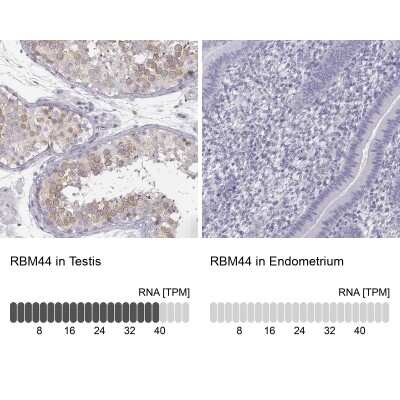 Immunohistochemistry-Paraffin: RBM44 Antibody [NBP1-93779]