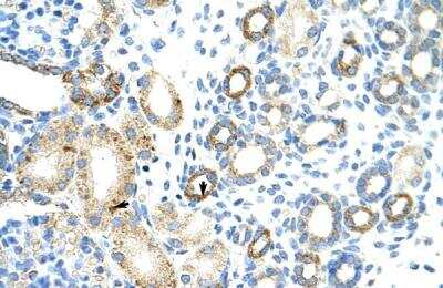 Immunohistochemistry-Paraffin: RBM46 Antibody [NBP1-80475]