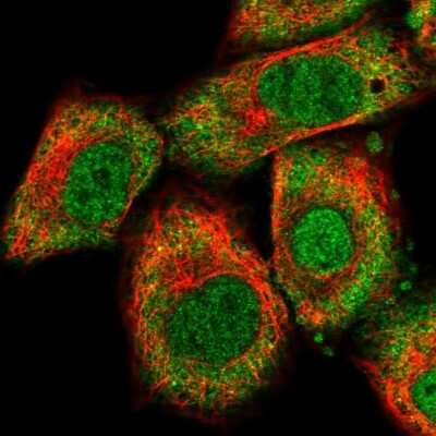 Immunocytochemistry/ Immunofluorescence: RBM47 Antibody [NBP1-83664]