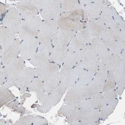 Immunohistochemistry-Paraffin: RBM47 Antibody [NBP1-83664]