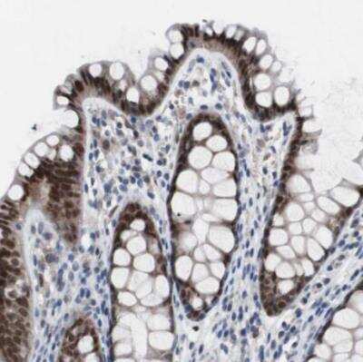 Immunohistochemistry-Paraffin: RBM47 Antibody [NBP1-83664]