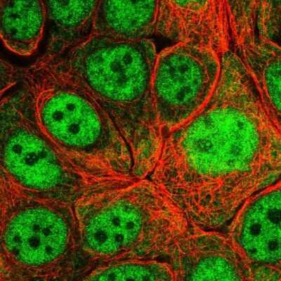 Immunocytochemistry/ Immunofluorescence: RBM4 Antibody [NBP2-33503]