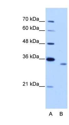 Western Blot: RBM4B Antibody [NBP1-80469]