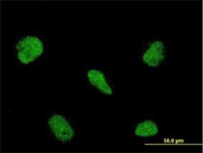 Immunocytochemistry/ Immunofluorescence: RBM5 Antibody (2B6) [H00010181-M01]
