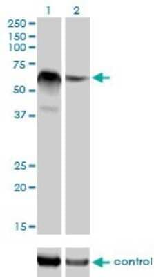 Western Blot: RBM5 Antibody (2B6) [H00010181-M01]