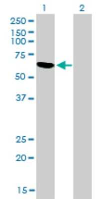 Western Blot: RBM5 Antibody (2B6) [H00010181-M01]