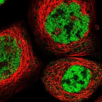 Immunocytochemistry/ Immunofluorescence: RBM5 Antibody [NBP1-83304]