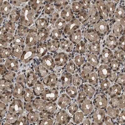 Immunohistochemistry-Paraffin: RBM5 Antibody [NBP1-83305]