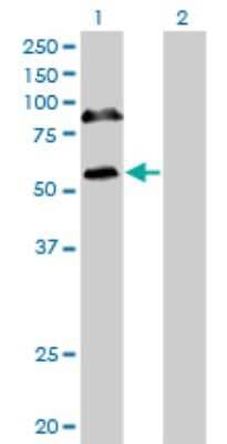 Western Blot: RBM6 Antibody (4B3) [H00010180-M16]