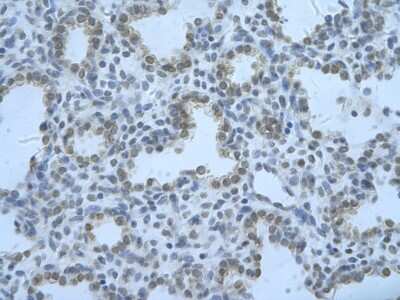 Immunohistochemistry: RBM8A Antibody [NBP1-57274]