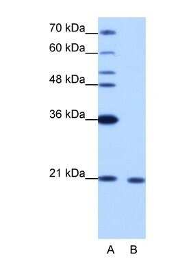 Western Blot: RBM8A Antibody [NBP1-57274]