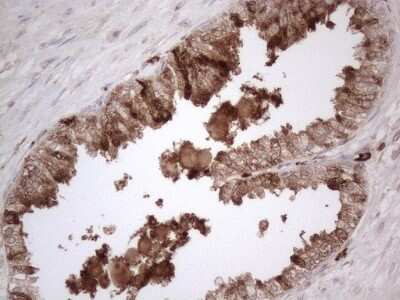 Immunohistochemistry: RBMS1 Antibody (OTI2H1) [NBP2-45533]