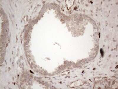 Immunohistochemistry: RBMS1 Antibody (OTI2H1) [NBP2-45533]