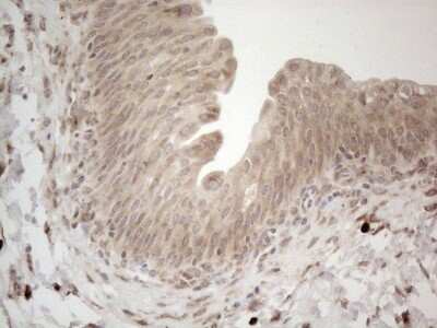 Immunohistochemistry: RBMS1 Antibody (OTI2H1) [NBP2-45533]