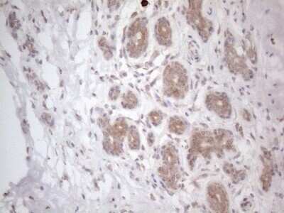 Immunohistochemistry: RBMS1 Antibody (OTI2H1) - Azide and BSA Free [NBP2-73834]