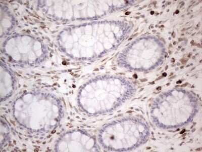 Immunohistochemistry: RBMS1 Antibody (OTI2H1) - Azide and BSA Free [NBP2-73834]