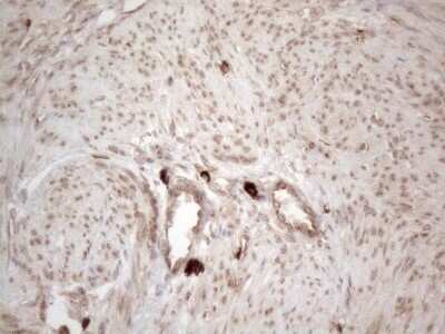 Immunohistochemistry: RBMS1 Antibody (OTI2H1) - Azide and BSA Free [NBP2-73834]