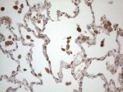 Immunohistochemistry: RBMS1 Antibody (OTI2H1) - Azide and BSA Free [NBP2-73834]