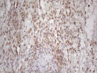 Immunohistochemistry: RBMS1 Antibody (OTI2H1) - Azide and BSA Free [NBP2-73834]