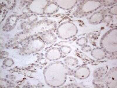 Immunohistochemistry: RBMS1 Antibody (OTI2H1) - Azide and BSA Free [NBP2-73834]