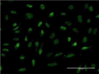 Immunocytochemistry/ Immunofluorescence: RBMS2 Antibody (3B2) [H00005939-M03]