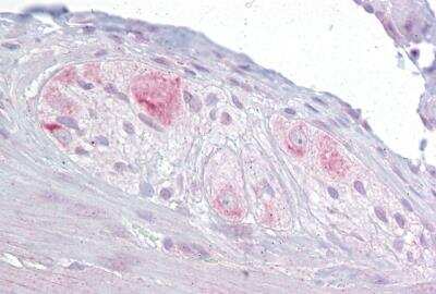 Immunohistochemistry-Paraffin: RBMS3 Antibody [NBP1-57357]