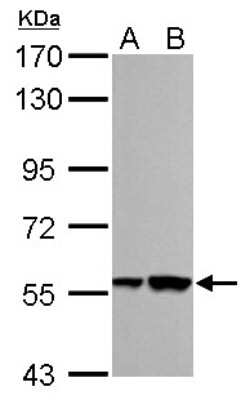 Western Blot: RBMY1A1 Antibody [NBP1-32887]
