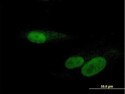 Immunocytochemistry/ Immunofluorescence: RBMY1F Antibody [H00159163-B01P]